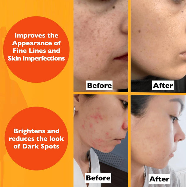 Radiant Glow Vitamin Serum