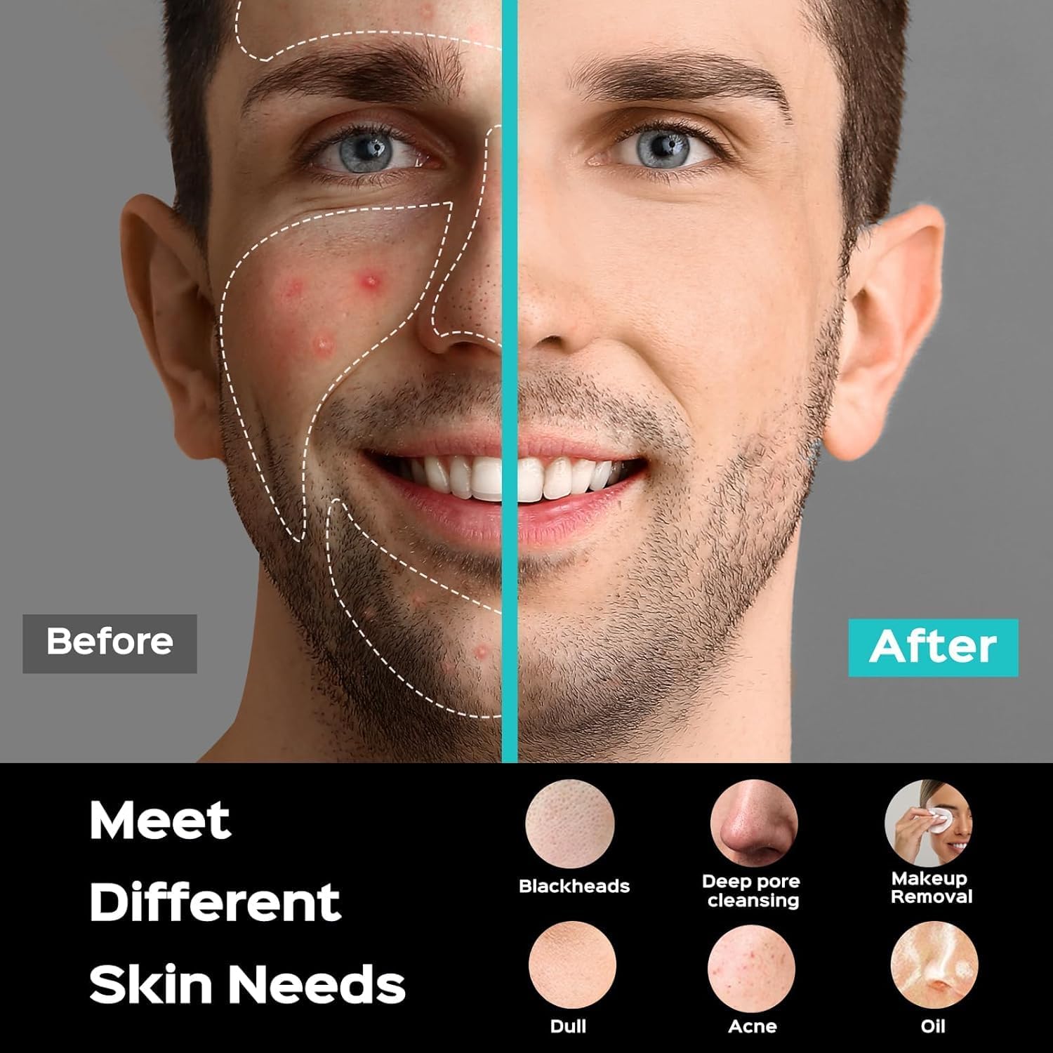 GlowWave Facial Brush