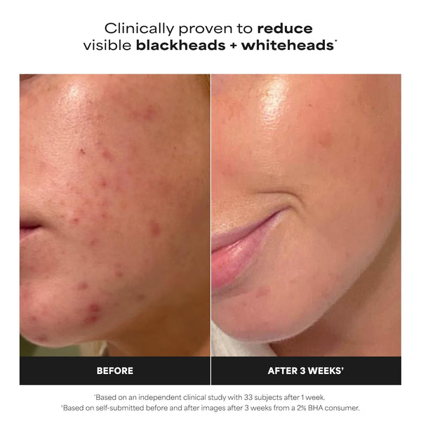 Smooth Glow Exfoliant Liquid
